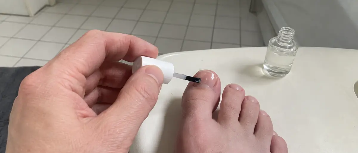 Hand som penslar på nagelsvampslack på stortåns nagel ovanifrån